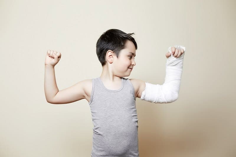 Băiețel arătându-și mândru „mușchii”, cu gips pe antebraț